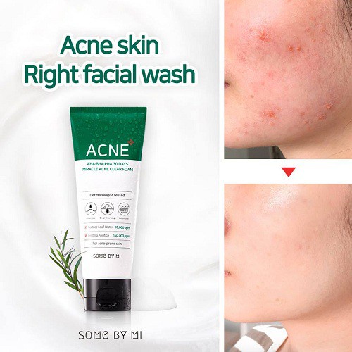 Ảnh Sữa Rửa Mặt Ngừa Mụn Some By Mi AHA-BHA-PHA 30 Days Miracel Acne Clear Foam 2