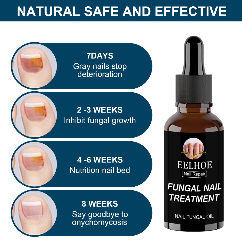 Ảnh Tinh chất phục hồi móng EELHOE ANNIES 30ml/ 50ml loại bỏ nấm chăm sóc móng tay móng chân 4