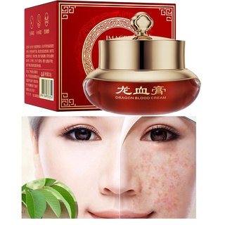 Kem nám và chống tàn nhang thảo dược SÂM NẤM LINH CHI da trắng sáng và dưỡng ẩm - Hiệu quả chỉ 28 ngày sử dụng
