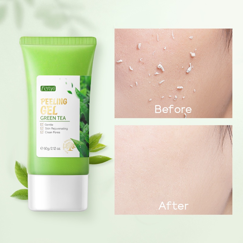 Ảnh Gel tẩy tế bào chết FENYI chiết xuất trà xanh tẩy mụn đầu đen làm sạch lỗ chân lông hiệu quả chuyên dụng 60g 1