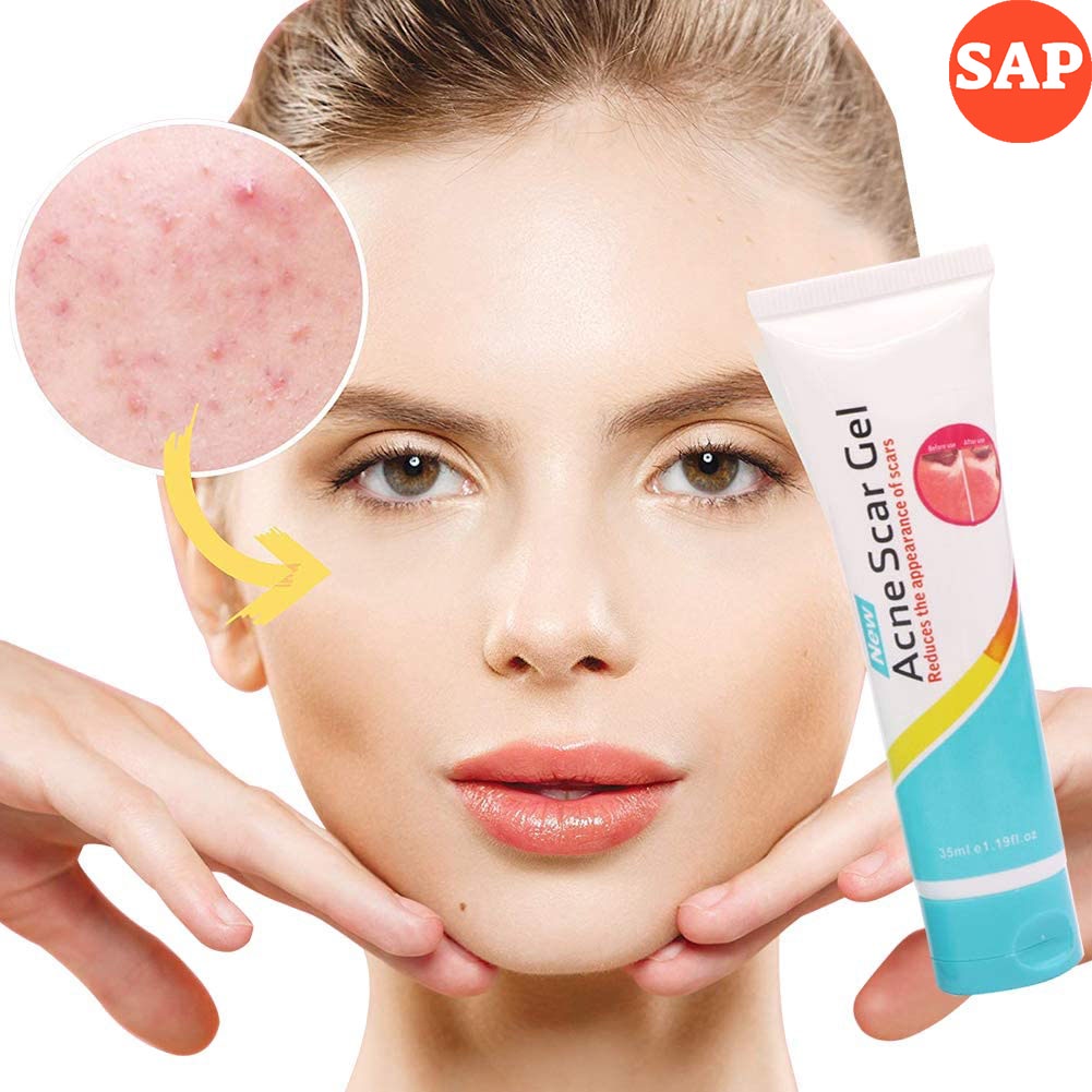 Gel Giảm Mụn, Mờ Sẹo Thâm Do Mụn, Sẹo Do Phẫu Thuật Laoshiya Acne scar gel