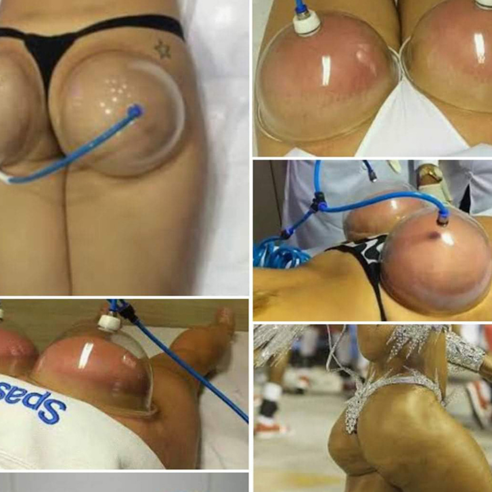 [Hàng mới về] Dụng cụ hút chân không nâng mông tiện lợi