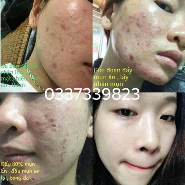 Serum tái tạo da Ngọc Linh Sâm