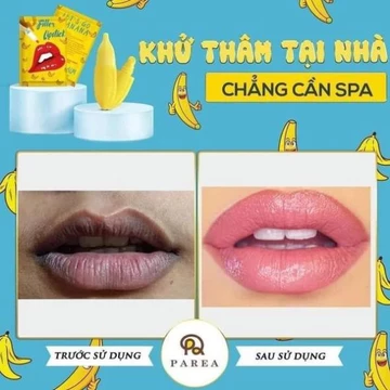 𝐒𝐎𝐍 𝐇𝐎̂̀𝐍𝐆 𝐌𝐎̂𝐈 𝐓𝐇𝐀̂𝐌 𝐅𝐈𝐋𝐋𝐄𝐑 𝐋𝐈𝐏𝐒𝐓𝐈𝐂𝐊 - Son Khử Thâm Môi Parea Chính Hãng 💄