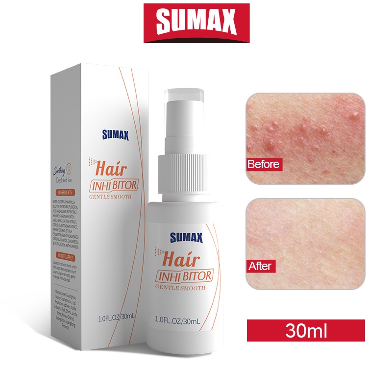 Ảnh Chai xịt ức chế mọc lông SUMAX thích hợp cho vùng tay/ chân/ nách/ bikini cho nam nữ 30ml100g 1