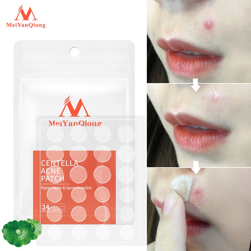 Ảnh MeiYanQiong Miếng dán lột mụn giảm mụn đầu đen Phục Hồi àm làm  sạch sâu Da cho vùng mũi 24 viên 4