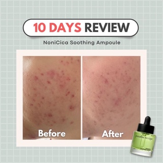 Serum giảm mụn phục hồi PESTLO Pantherecipe Nonicica Soothing 30ml