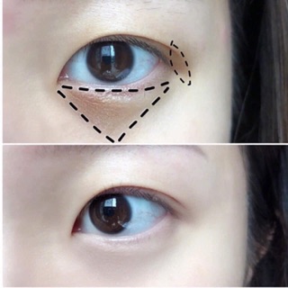 Kem Dưỡng Mắt Meishoku Whitening Eye Cream
