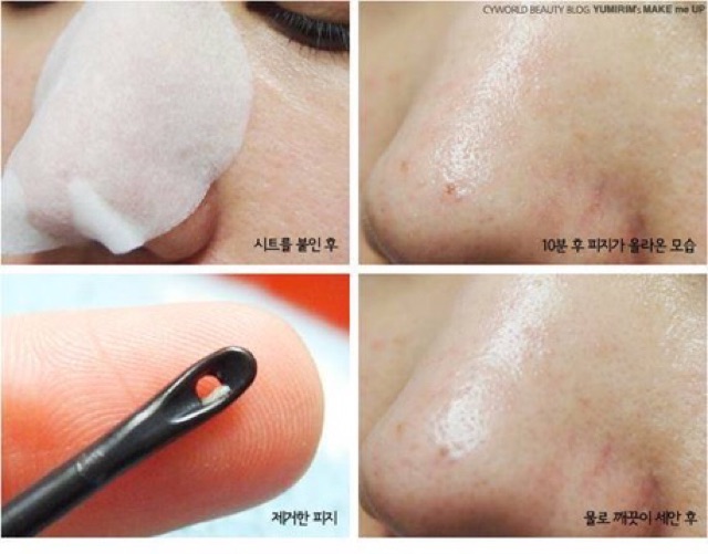 Miếng Đẩy Mụn Đầu Đen Ciracle Goodbye Blackhead | Shopee Việt Nam