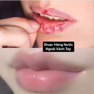 [CHỈ BÁN HÀNG THÁI] SON DƯỠNG HỒNG MÔI,KHỬ THÂM,KHÔ MÔI THÁI LAN [SẴN][FREESHIP][HÀNG CHUẪN][KO BÁN HÀNG TQ]