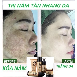 BỘ Kem nám và chống tàn nhang thảo dược SIÊU ĐỈNH TRẮNG TÂY THI trắng sáng và dưỡng ẩm - Hiệu quả chỉ 28 ngày sử dụng