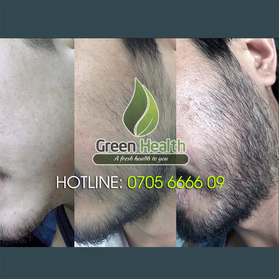 Serum Mọc Râu – Tóc – Dưỡng Chân Mày Minoxidil 5% Kirkland Của Hoa Kỳ