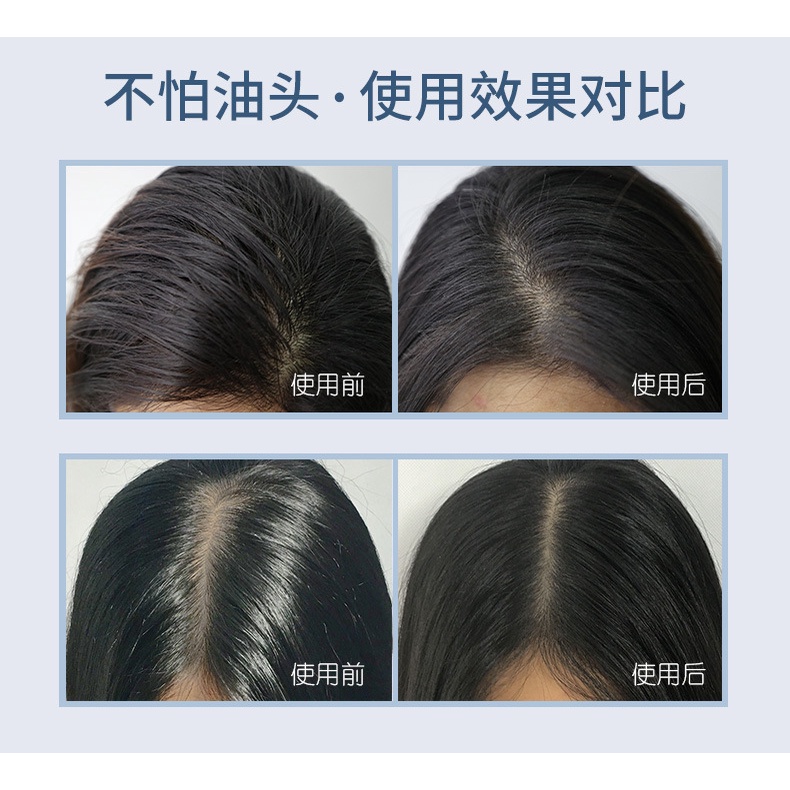Dầu gội đầu khô Issy – xịt đầu khô hết ngứa & bết dính tóc 150ml