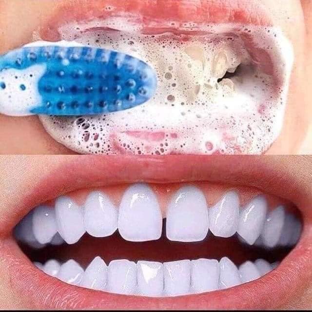 Median Dental – Kem Đánh Trắng Răng Hàn Quốc 120g