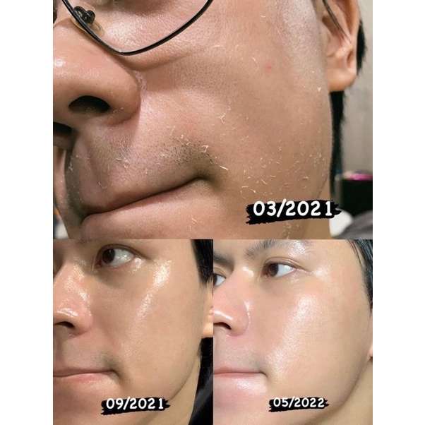 Serum oh!oh! Niacinamide 20% Dưỡng Sáng Da, Giảm Thâm Nám, Thu Nhỏ Lỗ Chân Lông Ohoh Skin Health 10ml/30ml