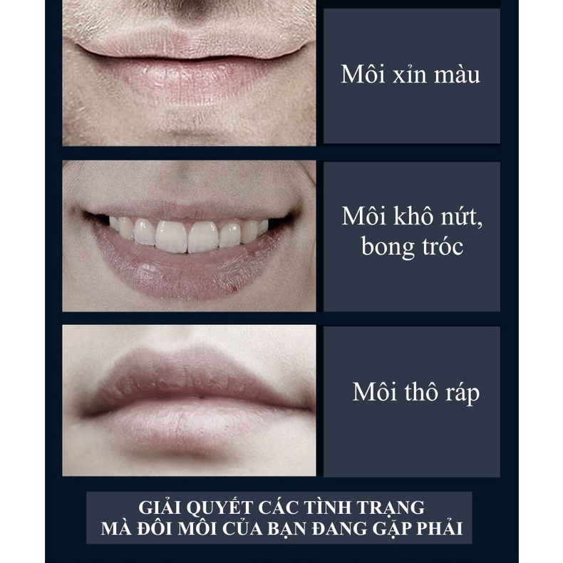 Son dưỡng môi cho nam VENZEN giúp dưỡng ẩm, giảm thâm, môi căng mọng, mặt nạ môi chống khô môi, dưỡng môi nam giới KH03