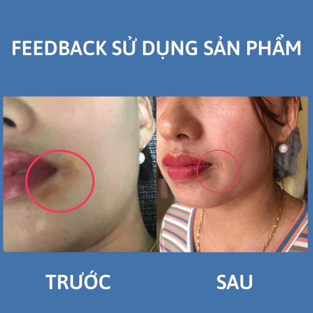Serum Thâm Nách Bẹn Mông Đầu Gối Natural Pink 15ml .Tinh chất khử thâm làm sáng vùng da thâm hiệu quả