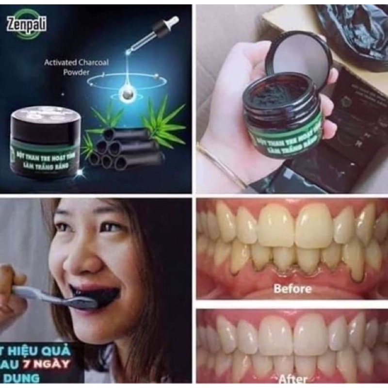 [CAM KẾT CHUẨN HÃNG] Bột than tre hoạt tính trắng răng Zenpali