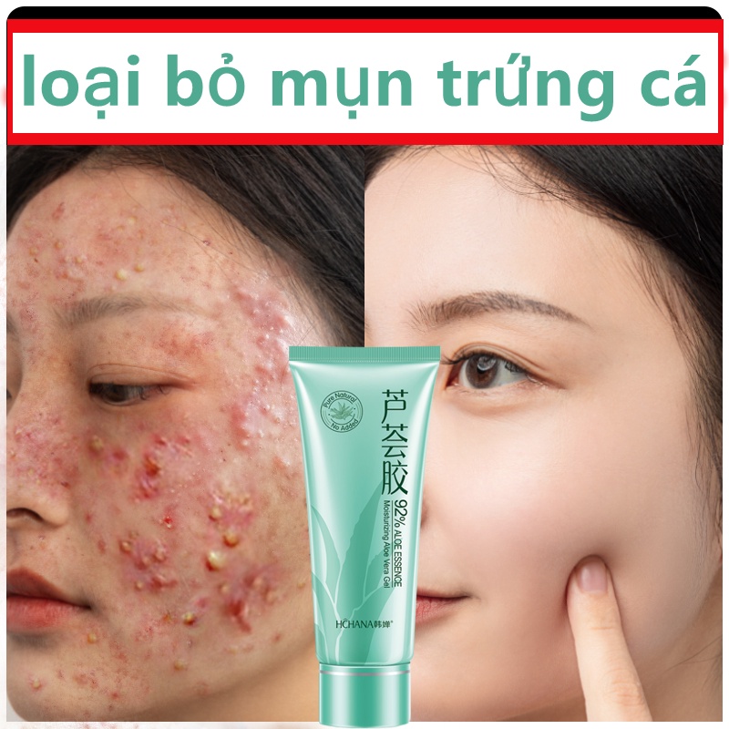 Gel nha đam Gel Lô Hội Kem Mụn 40g làm mờ vết thâm sẹo phục hồi sẹo phục hồi sau cháy nắng giảm thâm kem giữ ẩm