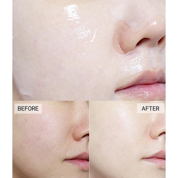 Mặt Nạ Mediheal