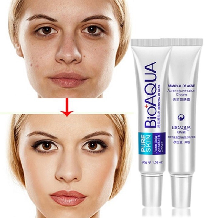 [SIÊU HOT] Kem dưỡng da MỤN trắng da BIOAQUA CỰC TỐT – Kem Lành Mụn Nội Địa Trung B33