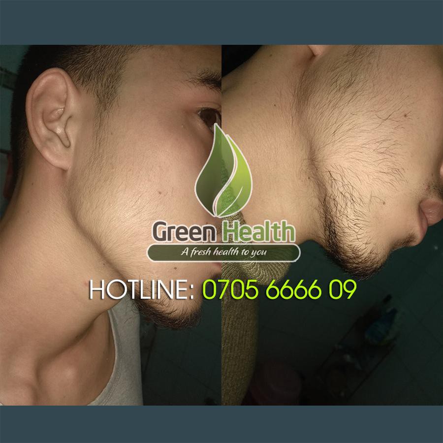 [RẺ NHẤT – Date MỚI nhất] Minoxidil 5% dạng lỏng chính hãng Kirkland Hoa Kỳ