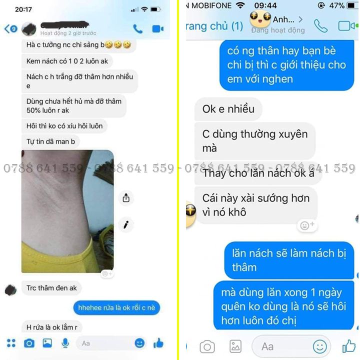Kem Thâm Nách Hôi Nách, Kem Cô Bơ Đông Y Gia Truyền, Giúp Loại Bỏ Mùi Hôi Nách Dưỡng Trắng Nách, Chiết Xuất Từ Thảo Dược