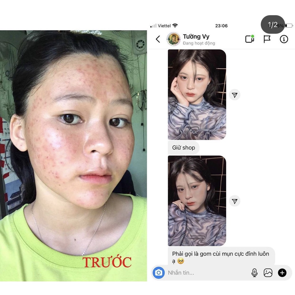 Bộ 2 lọ serum ngăn ngừa mụn và thâm , se khít lỗ chân lông giúp da sáng mịn 9DAYS SKIN 10ml