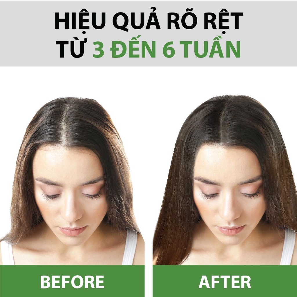 Tinh Dầu Bưởi Ngừa Rụng & Kích Thích Mọc Tóc – Xịt Bưởi Mọc Tóc MILAGANICS 100ml (Chai)