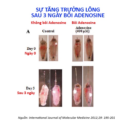 [MUA 5 TẶNG 2] Bột Adenosine nguyên chất, nguyên liệu mỹ phẩm râu tóc bôi kèm minoxidil, giúp mọc & dày cứng râu tóc