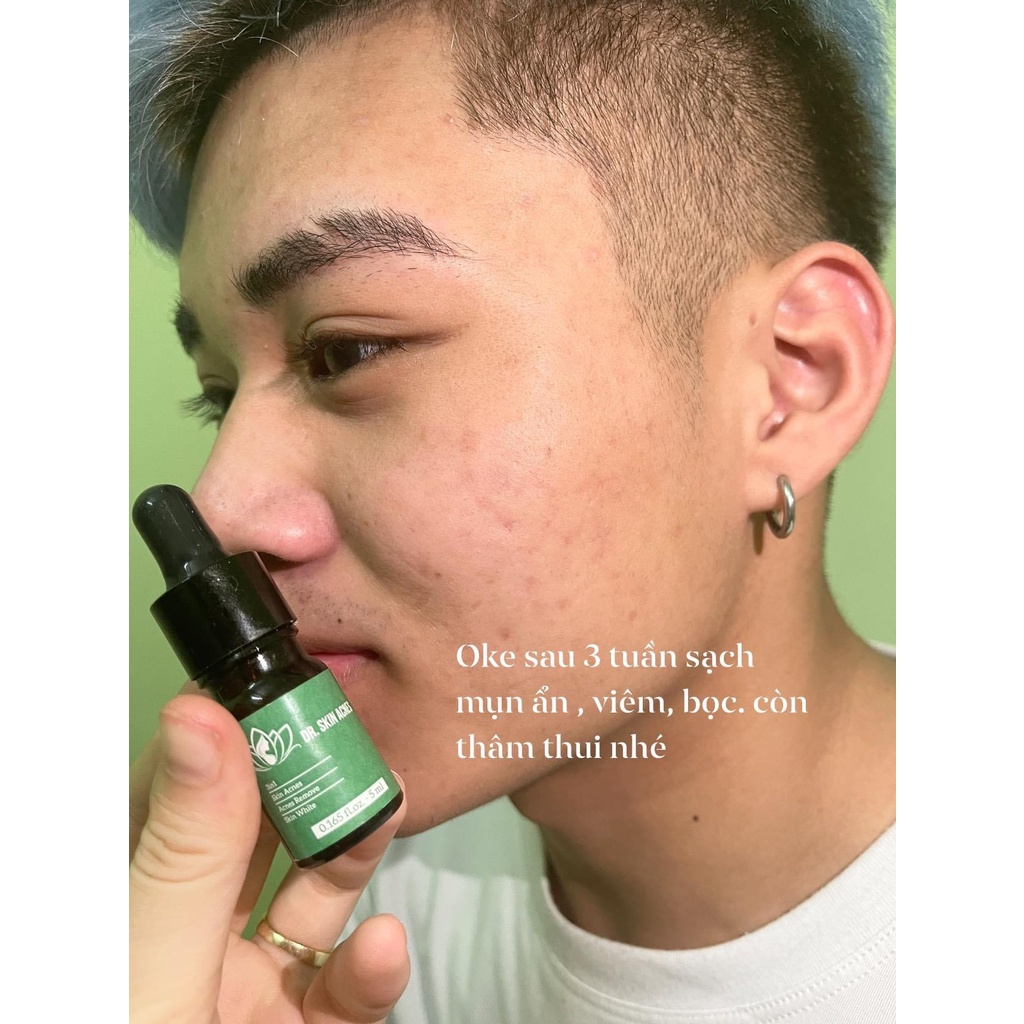 Serum mụn thảo dược Dr.Skin acnes, đánh bay mụn, sạch thâm trong 7 ngày