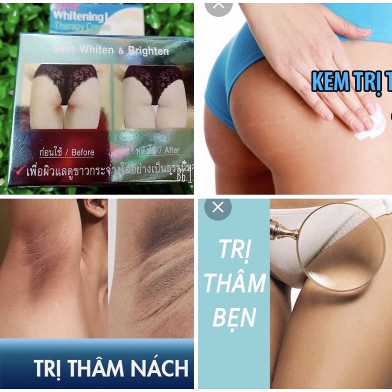 [Chỉ Bán Hàng Thái] Kem thoa thâm Mông, mụn Mông, Bẹn, Nách, Lưng, Nhũ hoa, Cùi chỏ, Đầu gối …. Thái Lan