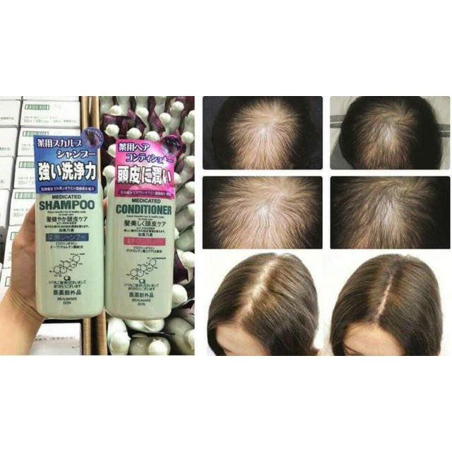 Dầu Gội Xả Kaminomoto Medicated Giảm Rụng Tóc Kích Mọc Tóc Nhật Bản 300ml