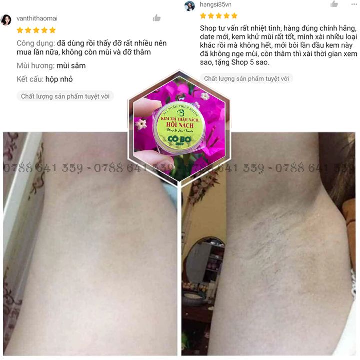 Kem Thâm Nách Hôi Nách, Kem Cô Bơ Đông Y Gia Truyền, Giúp Loại Bỏ Mùi Hôi Nách Dưỡng Trắng Nách, Chiết Xuất Từ Thảo Dược