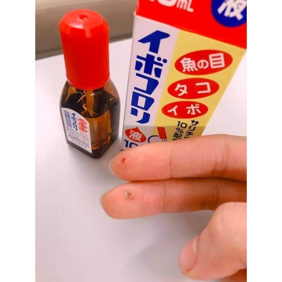 Dung dịch loại bỏ dứt điểm Mụn cóc Mụn cơm Ibokorori của Nhật Bản