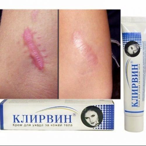 kem mờ sẹo klirvin nga kem xoá sẹo lồi lõm rỗ mờ thâm mụn rạn da ngừa mụn giảm thâm mắt [??̣̆?? ??́? ???????? ??̣̆?]
