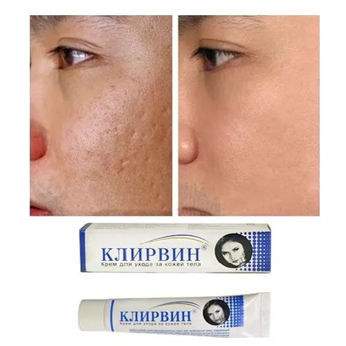 Kem Sẹo KLIRVIN Nga Giảm Thâm Mờ Sẹo Rạn Da Tuýp 25g