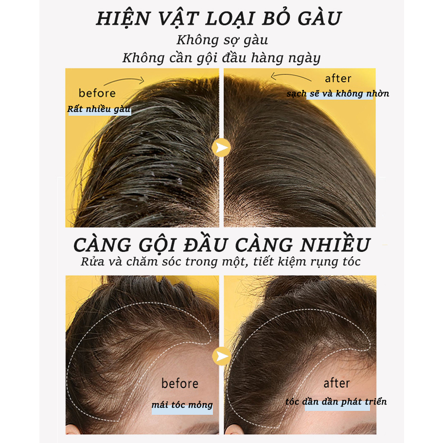 Dầu gội mọc tóc kích thích mọc tóc dầu gội chống rụng tóc [300ml] loại bỏ gàu, dưỡng tóc