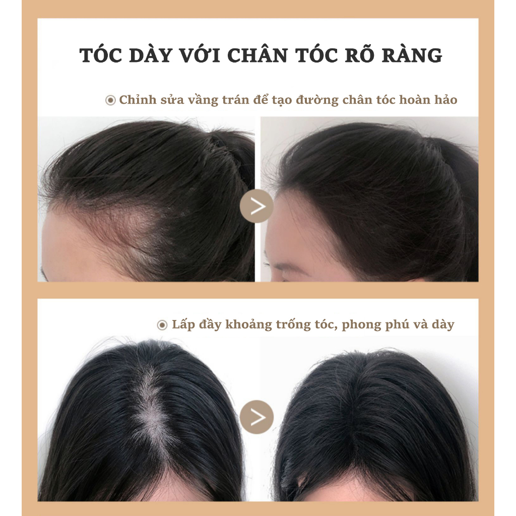Dầu gội mọc tóc kích thích mọc tóc dầu gội chống rụng tóc [300ml] loại bỏ gàu, dưỡng tóc