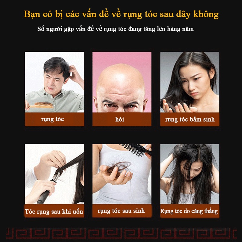 【CHÍNH HÃNG 100%】Tinh dầu mọc tóc Mọc lại tóc 30ml nuôi dưỡng tóc tinh chất dưỡng tóc làm chắc khỏe chân tóc, ngăn ngừa rụng tóc, phục hồi tóc hư tổn
