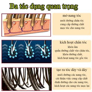 【CHÍNH HÃNG 100%】Tinh dầu mọc tóc Mọc lại tóc 30ml nuôi dưỡng tóc tinh chất dưỡng tóc làm chắc khỏe chân tóc, ngăn ngừa rụng tóc, phục hồi tóc hư tổn