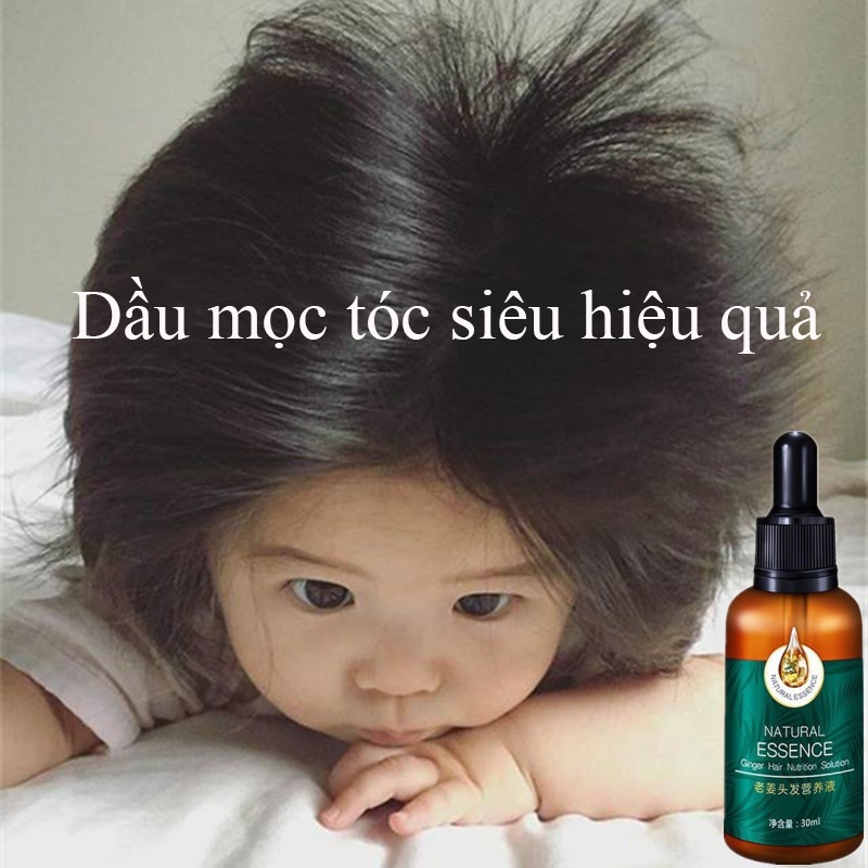 👍🏻Chính Hãng👍🏻Tinh chất mọc tóc tinh dầu mọc tóc 30ml serum kích mọc tóc chăm sóc tóc chống rụng tóc,kích thích tóc mọc dà🔥 Rẻ nhất 🔥