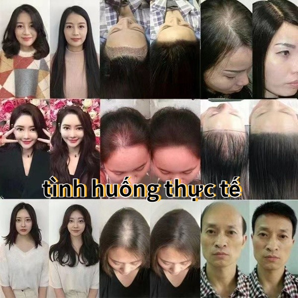 👍🏻Chính Hãng👍🏻Tinh chất mọc tóc tinh dầu mọc tóc 30ml serum kích mọc tóc chăm sóc tóc chống rụng tóc,kích thích tóc mọc dà🔥 Rẻ nhất 🔥