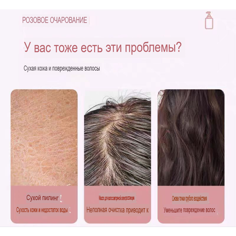 Dầu Gội Đầu Chống Gàu Kiểm Soát Dầu Lâu Trôi Nuôi Dưỡng Da Đầu Mềm Mại