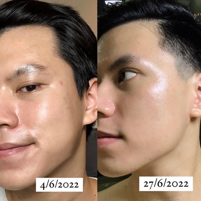 Serum oh!oh! Niacinamide 20% Dưỡng Sáng Da, Giảm Thâm Nám, Thu Nhỏ Lỗ Chân Lông Ohoh Skin Health 10ml/30ml