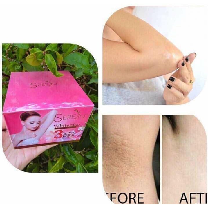 Giảm thâm Seren 3 day mờ thâm nách thâm bẹn thâm mông thâm đầu gối khử mùi hôi nách hồng nhũ hoa]]]