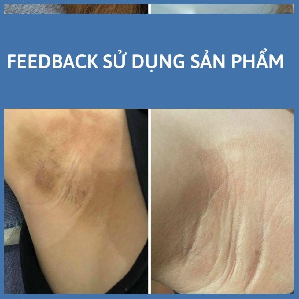Serum Thâm Nách Bẹn Mông Đầu Gối Natural Pink 15ml .Tinh chất khử thâm làm sáng vùng da thâm hiệu quả