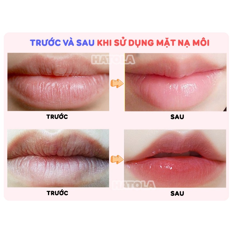 Mặt nạ môi collagen dưỡng môi căng bóng, hồng hào mask môi nội địa trung Hatola