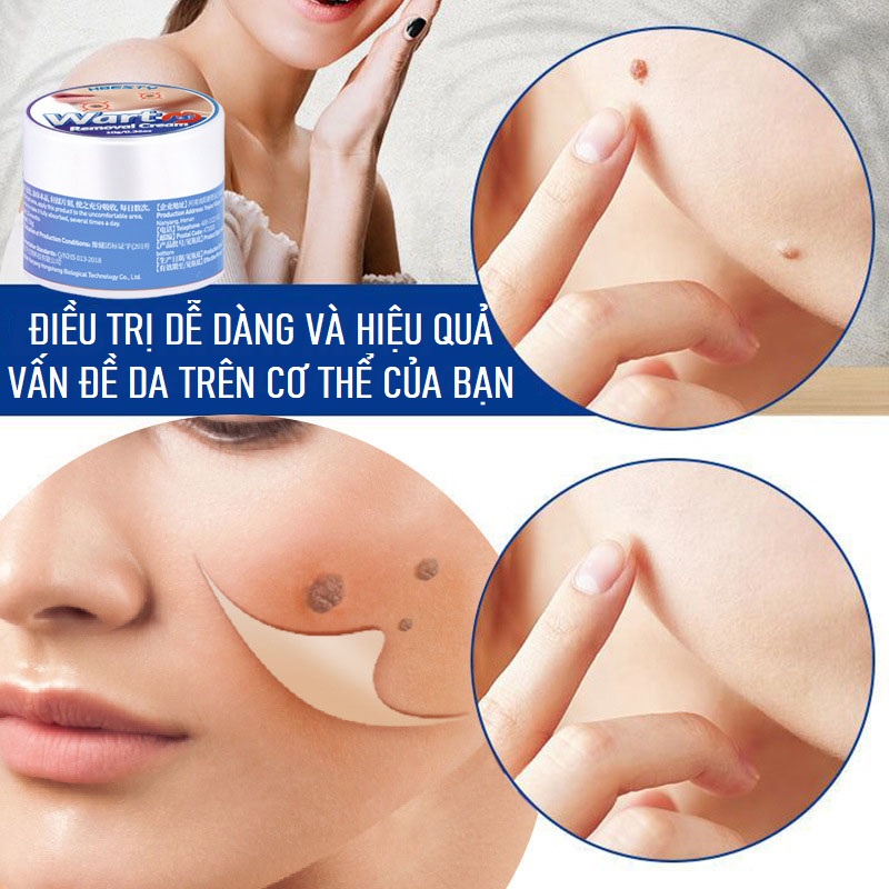 Kem Loại Bỏ Mụn HBESTY Wart Remover Cream Cam Kết Loại Bỏ Mụn Cóc, Mụn Thịt, Sẹo Lồi Gây Hại Cho Da
