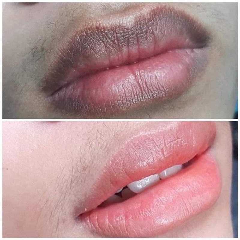 Dưỡng Cấy Màu Môi Combo [FREESHIP TOÀN QUỐC] Tế Bào Gốc Thiên Di Tẩy Thâm Môi Cấy Hồng Môi Tự Nhiên Kích Màu Phun Xăm 24